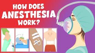 How does anesthesia work? - Types of anesthesia - Video for Kids - Learning Junction