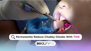 PERMANENTLY Contour Your Cheeks! | BeautyFix