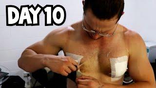 GYNO SURGERY RECOVERY DAY 10 | GOING TO THE EMERGENCY DEPARTMENT WITH TWO GIANT HEMATOMAS!