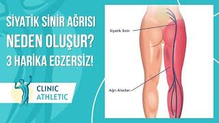 Siyatik Sinir Ağrısı Neden Oluşur? | 3 Harika Egzersiz!