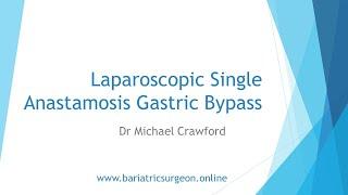 Single Anastamosis Gastric Bypass with Dr Michael Crawford