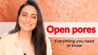 Open pores| How to treat | Creams to use | Lasers  | Dermatologist| Dr Aanchal