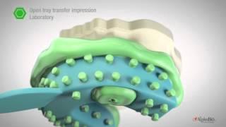 How to take open/ close tray impression? | Alpha-Bio Tec.