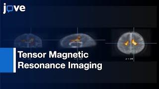 DTI for the Analysis of Neurodegenerative Diseases | Protocol Preview