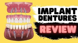 Implant Dentures vs Snap In Dentures vs All on 4