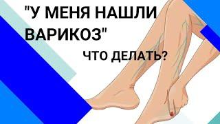 У МЕНЯ НАШЛИ ВАРИКОЗ: что делать?