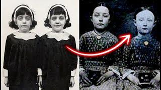 Did These Twins Live Twice? The Untold Story of the Pollock Twins