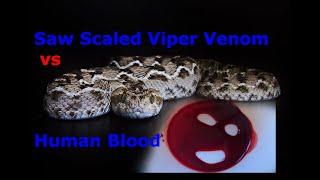 Saw Scaled Viper Venom vs Human Blood