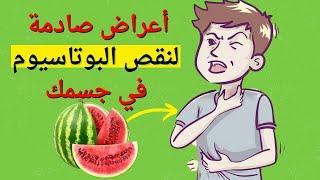 ٧ أعراض لن تتوقعها تنذرك بنقص البوتاسيوم | ٧ أغنى المأكولات بالبوتاسيوم