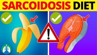 Sarcoidosis Diet | ONLY Eat These Foods (and Which Ones to AVOID)