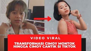 VIRAL! TRANSFORMASI ARTIS TIKTOK CIMOY MONTOK HINGGA CIMOY CANTIK!