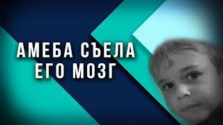 АМЁБА СЪЕЛА МОЗГ СЕМИЛЕТНЕГО МАЛЬЧИКА: Реальная История #Shorts