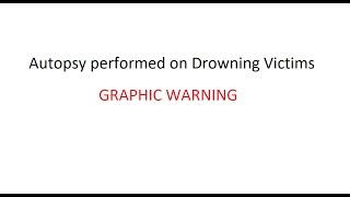 Autopsy performed on Drowning Victims | Dr.Parmod Goyal