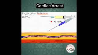 ADRENALINE (Epinephrine) DOSE in CARDIAC ARREST #pediatrics #medicine #epinephrine