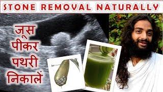 Homemade Vegetable Drink to Remove Stone -  Gall bladder & Kidney Stone