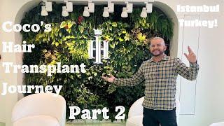 Hair Transplant Journey: Here's how it went! | Istanbul Turkey