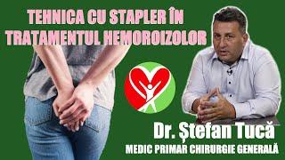 TEHNICA MODERNA IN TRATAMENTUL HEMOROIZILOR - DR. STEFAN TUCA - MEDIC PRIMAR CHIRURGIE GENERALA