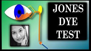 Jones Dye Test - 1 & 2 | Lacrimal Drainage Disorders | Oculoplasty