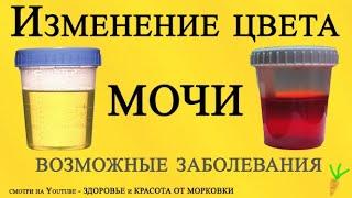 О ЧЕМ ПРЕДУПРЕЖДАЕТ ИЗМЕНЕННЫЙ ЦВЕТ МОЧИ