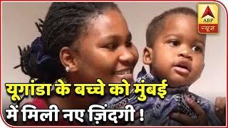 Mumbai Doctors Cure Uganda Child Suffering From Sturge Weber Syndrome | ABP News