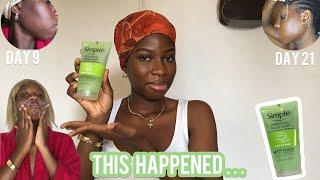 3 Weeks Of Using Simple Refreshing Face Wash | I broke Out!! | Simple skincare review