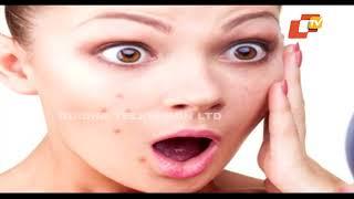 STAY FIT | Prp Treatment |The Secret To Younger Looking Skin |No Sugar Diet | Health Benefits