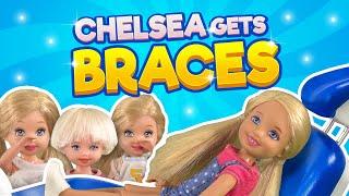 Barbie - Chelsea Gets Braces | Ep.327