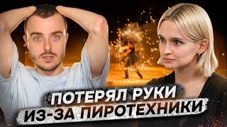 ‎Потерял руки из-за пиротехники | Костя Бионическая Россия