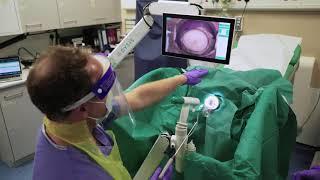 Cervical Rotating Biopsy Punch & LLETZlearn® Training Simulator in Conjunction with DYSIS Medical