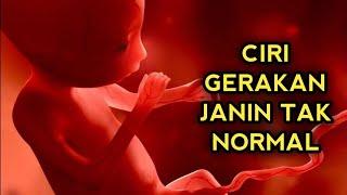 CIRI-CIRI GERAKAN JANIN YANG TIDAK NORMAL