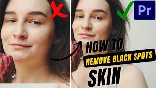 HOW TO REMOVE SKIN BLEMISH in Premiere Pro CC 2020 in HINDI