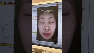 my first skin treatment in Korea #kbeauty #korea #seoul #beautytreatment