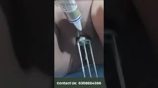 At Affordable Laser Vaginal Tightening Surgery By Expert Plastic Surgeon In Ahmedabad, Surat,Gujarat