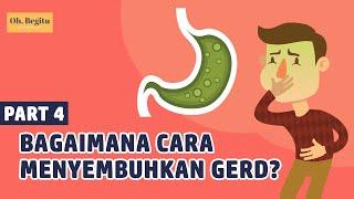 Bagaimana Cara Menyembuhkan GERD?