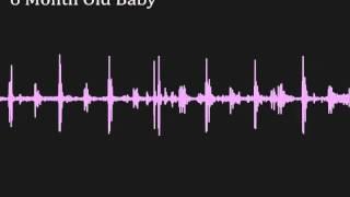 Recorded baby's heartbeat from a 6 month old infant