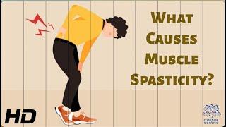 Muscle Spasticity: What's Really Going on and How to Treat It