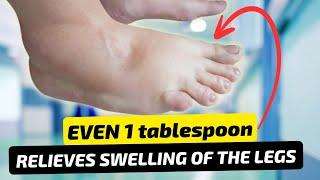 EDEMA: Swollen Feet, Swollen Ankles & Swollen Legs, FIX Them FAST!