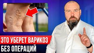 Лечение варикоза БЕЗ ОПЕРАЦИЙ и ЛЕКАРСТВ! Это проще чем вы думаете