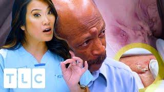 Top 3 Most Viewed Dr Pimple Popper videos in 2021 | Dr. Pimple Popper