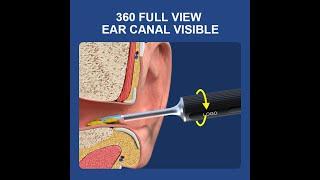 3 Million Pixels Visual Ear Cleaner Otoscope @X1