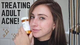 6 MONTH ACNE UPDATE || SPIRONOLACTONE