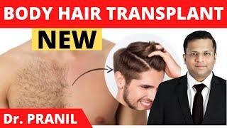 Body Hair Transplant (BHT) Fully Explained || Chest Hair Transplant Results