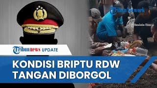 Tangan Briptu RDW Diborgol saat Dibakar Istri Sesama Polisi: Korban Minta Tolong, Pelaku Minta Maaf