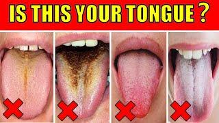 What Your Tongue Reveals About Your Health