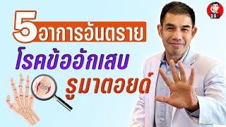 รูมาตอยด์ คืออะไร (Rheumatoid Arthritis) ปวดข้อแบบไหน สงสัยโรคข้ออักเสบรูมาตอยด์ - Doctor Kitcha