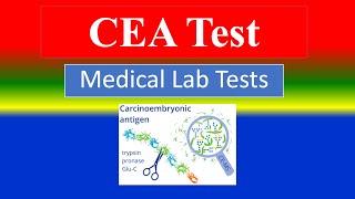 CEA. (carcinoembryonic antigen. ) Test  -  Lab Tests -  What is ?  , Uses ,Preparation , Results