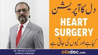 HEART SURGERY KYA HAI AUR KYUN KI JATI HAI - Cardiac Surgery In Urdu - Dil Ki Surgery Kaise Hoti Hai