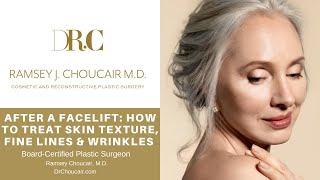 After Facelift Surgery: How to Treat Skin Texture & Wrinkles | Ramsey Choucair, M.D.|Ph:214-389-9797