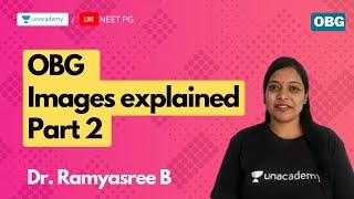 OBG Images explained Part 2 by Dr. Ramyasree B