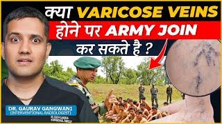 Can We Join Army If We Have Varicose Veins ? | Dr. Gaurav Gangwani (Interventional Radiologist)